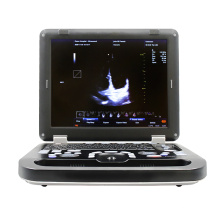 CONTEC CMS1700C Big -Deal tragbare Ultraschallmaschinen Farbe Doppler Medizinische Ultraschallinstrumente